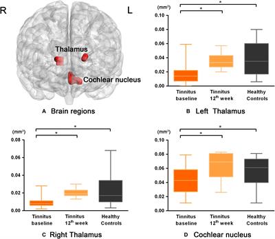 Neuroanatomical Alterations in Patients With Tinnitus Before and After Sound Therapy: A Voxel-Based Morphometry Study